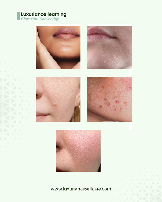 Understand your skin type